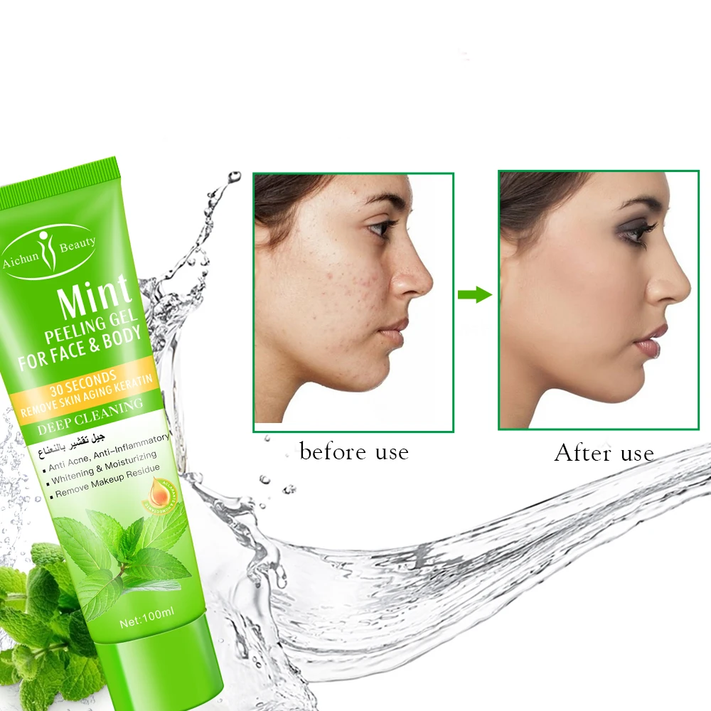 Aichun Beauty Gel Exfoliant Menthe 100ml - Peeling Deep Cleaning Anti Points Noirs*